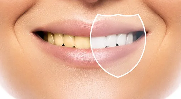 teeth whitening