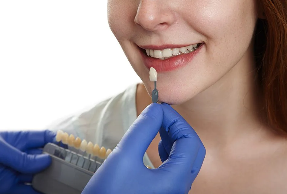 Veneers Treatment