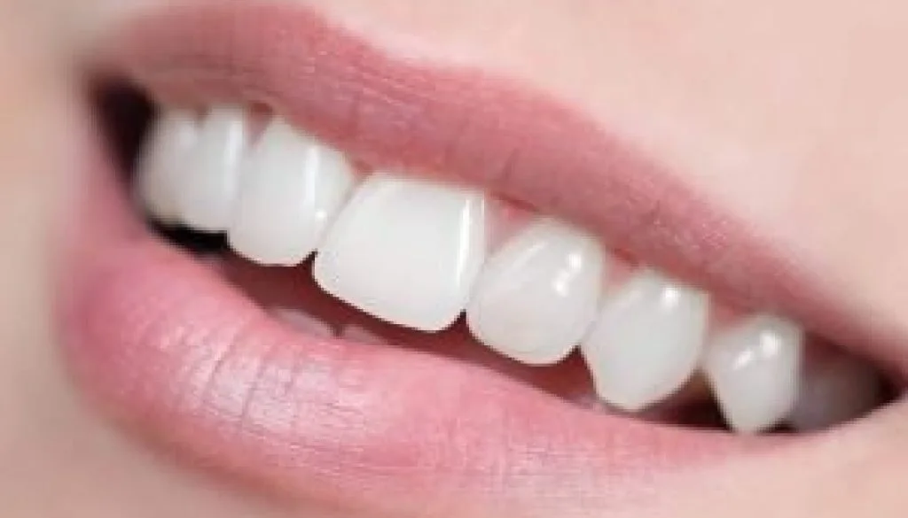 Teeth Whitening