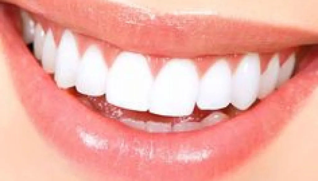 Composite Bonding