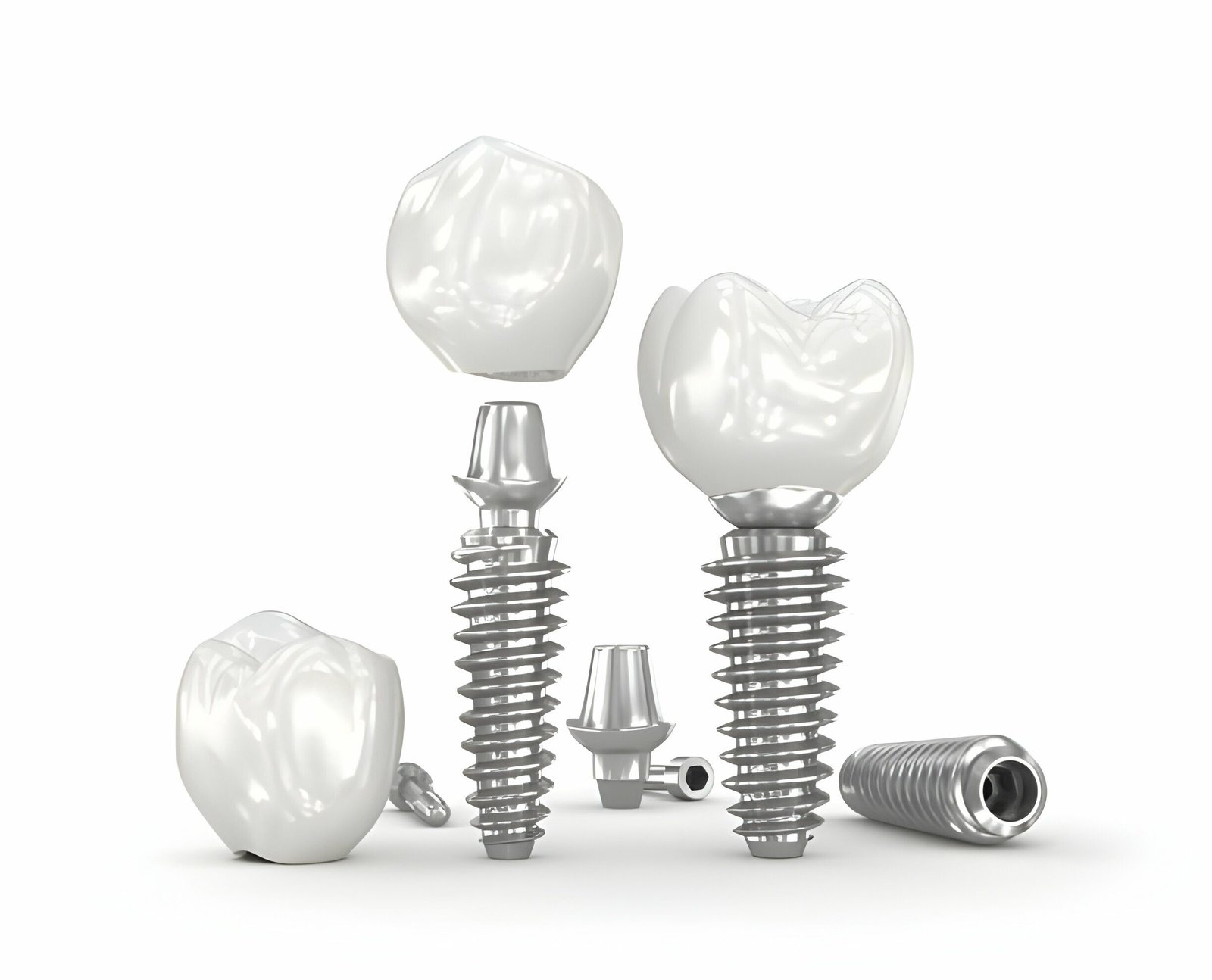 Can You Be Put to Sleep for Dental Implants in the UK?