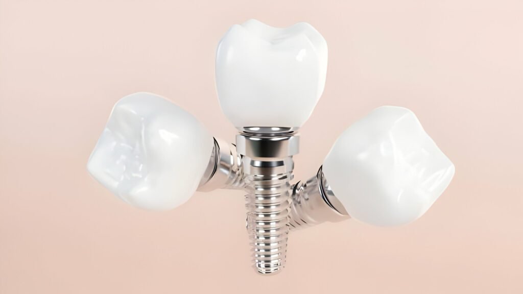 dental implant be removed and replaced