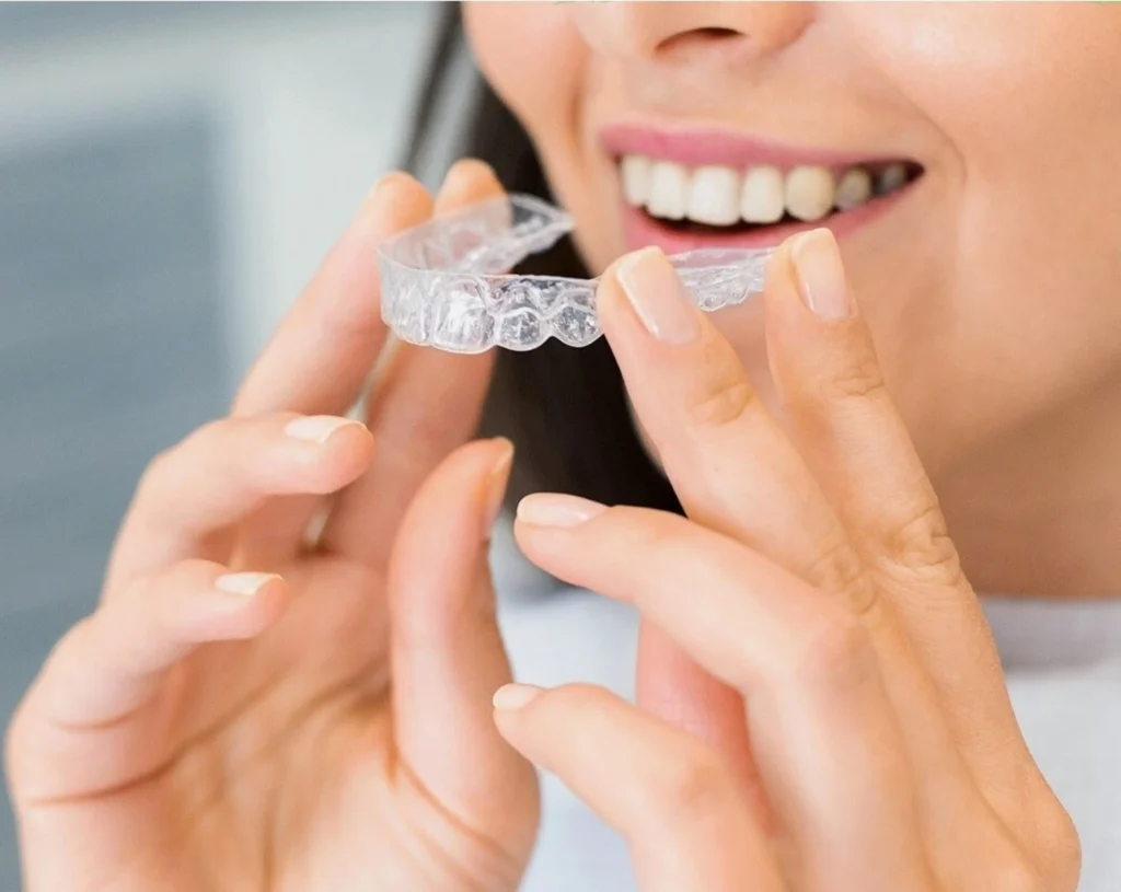 NHS covers Invisalign