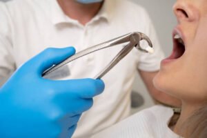 Dentist Pull a Tooth That Is Broken Off at the Gum Line